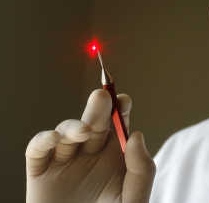 Types of lasers used in surgery
